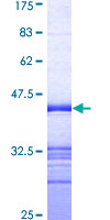 MAPK8IP2 / JIP2 Protein - 12.5% SDS-PAGE Stained with Coomassie Blue.