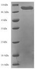 MAPKAP1 / MIP1 Protein - (Tris-Glycine gel) Discontinuous SDS-PAGE (reduced) with 5% enrichment gel and 15% separation gel.