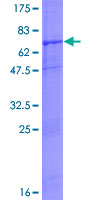 MAPKAP1 / MIP1 Protein - 12.5% SDS-PAGE of human MAPKAP1 stained with Coomassie Blue