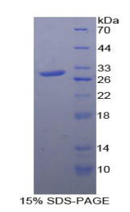 MAPKAPK2 / MAPKAP Kinase 2 Protein - Recombinant Mitogen Activated Protein Kinase Activated Protein Kinase 2 By SDS-PAGE