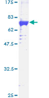 MAPKAPK3 Protein - 12.5% SDS-PAGE of human MAPKAPK3 stained with Coomassie Blue