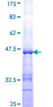 MAPKAPK3 Protein - 12.5% SDS-PAGE Stained with Coomassie Blue.