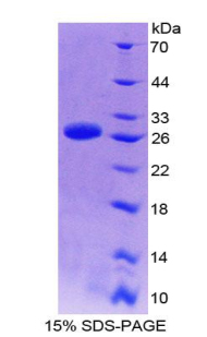 MAPKAPK3 Protein - Recombinant Mitogen Activated Protein Kinase Activated Protein Kinase 3 By SDS-PAGE