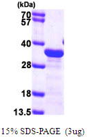 MAPRE1 / EB1 Protein