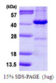 MAPRE2 / EB2 Protein