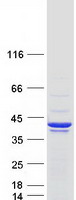 MAPRE2 / EB2 Protein - Purified recombinant protein MAPRE2 was analyzed by SDS-PAGE gel and Coomassie Blue Staining