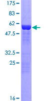 MAPRE3 / EB3 Protein - 12.5% SDS-PAGE of human MAPRE3 stained with Coomassie Blue