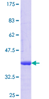 MAPRE3 / EB3 Protein - 12.5% SDS-PAGE Stained with Coomassie Blue.