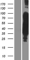 MAPT / Tau Protein - Western validation with an anti-DDK antibody * L: Control HEK293 lysate R: Over-expression lysate