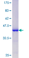 MAPT / Tau Protein - 12.5% SDS-PAGE Stained with Coomassie Blue.