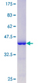 MAPT / Tau Protein - 12.5% SDS-PAGE Stained with Coomassie Blue.