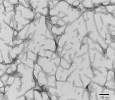 MAPT / Tau Protein - TEM of recombinant Tau441 (2N4R), P301S mutant preformed fibrils (PFFs) at 150kx magnification. HV = 80kV. Fibrils were sonicated and stained with uranyl acetate.