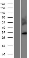 MARCH1 Protein - Western validation with an anti-DDK antibody * L: Control HEK293 lysate R: Over-expression lysate