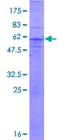 MARCH1 Protein - 12.5% SDS-PAGE of human MARCH1 stained with Coomassie Blue