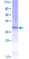 MARCH1 Protein - 12.5% SDS-PAGE Stained with Coomassie Blue.