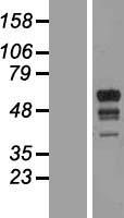MARCH10 Protein - Western validation with an anti-DDK antibody * L: Control HEK293 lysate R: Over-expression lysate