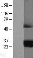 MARCH2 Protein - Western validation with an anti-DDK antibody * L: Control HEK293 lysate R: Over-expression lysate