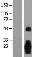 MARCH3 Protein - Western validation with an anti-DDK antibody * L: Control HEK293 lysate R: Over-expression lysate