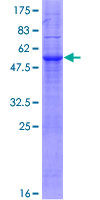MARCH3 Protein - 12.5% SDS-PAGE of human MARCH3 stained with Coomassie Blue