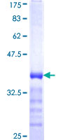 MARCH3 Protein - 12.5% SDS-PAGE Stained with Coomassie Blue.