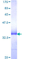 MARCH5 Protein - 12.5% SDS-PAGE Stained with Coomassie Blue.