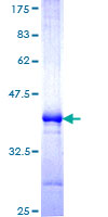 MARCH6 / DOA10 Protein - 12.5% SDS-PAGE Stained with Coomassie Blue.