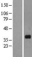 MARCH8 Protein - Western validation with an anti-DDK antibody * L: Control HEK293 lysate R: Over-expression lysate
