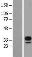 MARCH8 Protein - Western validation with an anti-DDK antibody * L: Control HEK293 lysate R: Over-expression lysate