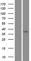 MARCH9 Protein - Western validation with an anti-DDK antibody * L: Control HEK293 lysate R: Over-expression lysate