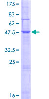 MARCH9 Protein - 12.5% SDS-PAGE of human MARCH9 stained with Coomassie Blue