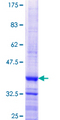 MARCH9 Protein - 12.5% SDS-PAGE Stained with Coomassie Blue.