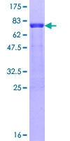 MARCKSL1 Protein - 12.5% SDS-PAGE of human MARCKSL1 stained with Coomassie Blue