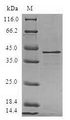 MARCKSL1 Protein - (Tris-Glycine gel) Discontinuous SDS-PAGE (reduced) with 5% enrichment gel and 15% separation gel.