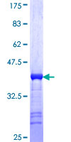 MARCKSL1 Protein - 12.5% SDS-PAGE Stained with Coomassie Blue.