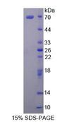 MARCKSL1 Protein - Recombinant MARCKS Related Protein (MARCKSL1) by SDS-PAGE