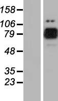 MARK2 Protein - Western validation with an anti-DDK antibody * L: Control HEK293 lysate R: Over-expression lysate