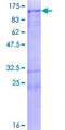 MARK2 Protein - 12.5% SDS-PAGE of human MARK2 stained with Coomassie Blue