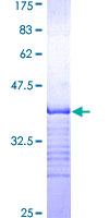 MARK2 Protein - 12.5% SDS-PAGE Stained with Coomassie Blue.