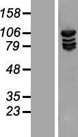 MARS Protein - Western validation with an anti-DDK antibody * L: Control HEK293 lysate R: Over-expression lysate