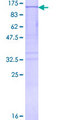 MARS Protein - 12.5% SDS-PAGE of human MARS stained with Coomassie Blue