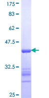 MARS Protein - 12.5% SDS-PAGE Stained with Coomassie Blue.
