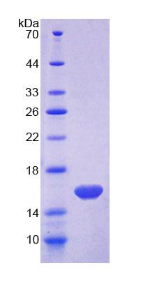 MARS Protein - Recombinant Methionyl tRNA Synthetase (MARS) by SDS-PAGE