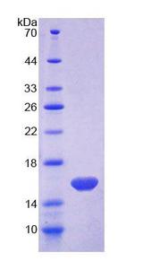 MARS Protein - Recombinant Methionyl tRNA Synthetase (MARS) by SDS-PAGE