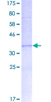 MARS2 Protein - 12.5% SDS-PAGE Stained with Coomassie Blue.