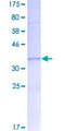 MARS2 Protein - 12.5% SDS-PAGE Stained with Coomassie Blue.