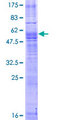 MAS1 / MAS Protein - 12.5% SDS-PAGE of human MAS1 stained with Coomassie Blue