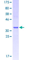 MAS1L / MRG Protein - 12.5% SDS-PAGE Stained with Coomassie Blue.