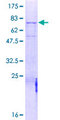 MASP1 / MASP Protein - 12.5% SDS-PAGE of human MASP1 stained with Coomassie Blue