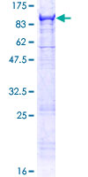 MASP2 / MASP-2 Protein - 12.5% SDS-PAGE of human MASP2 stained with Coomassie Blue