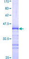 MAST1 Protein - 12.5% SDS-PAGE Stained with Coomassie Blue.